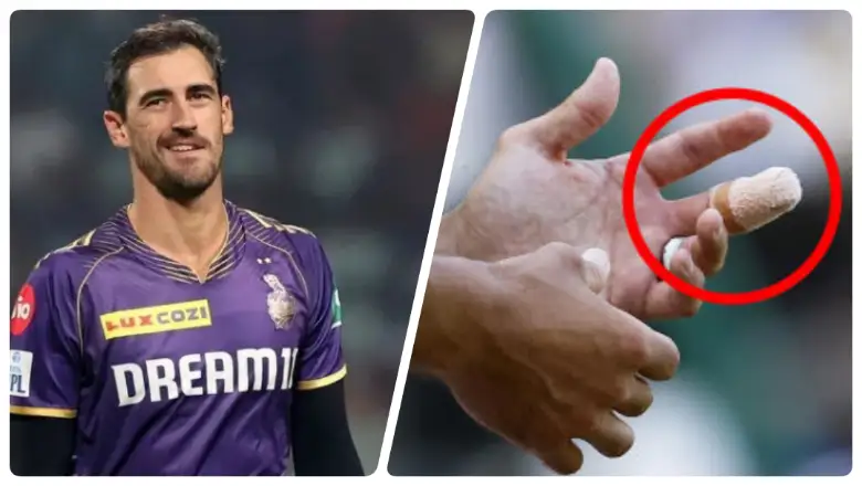 Mitchell Starc's injury